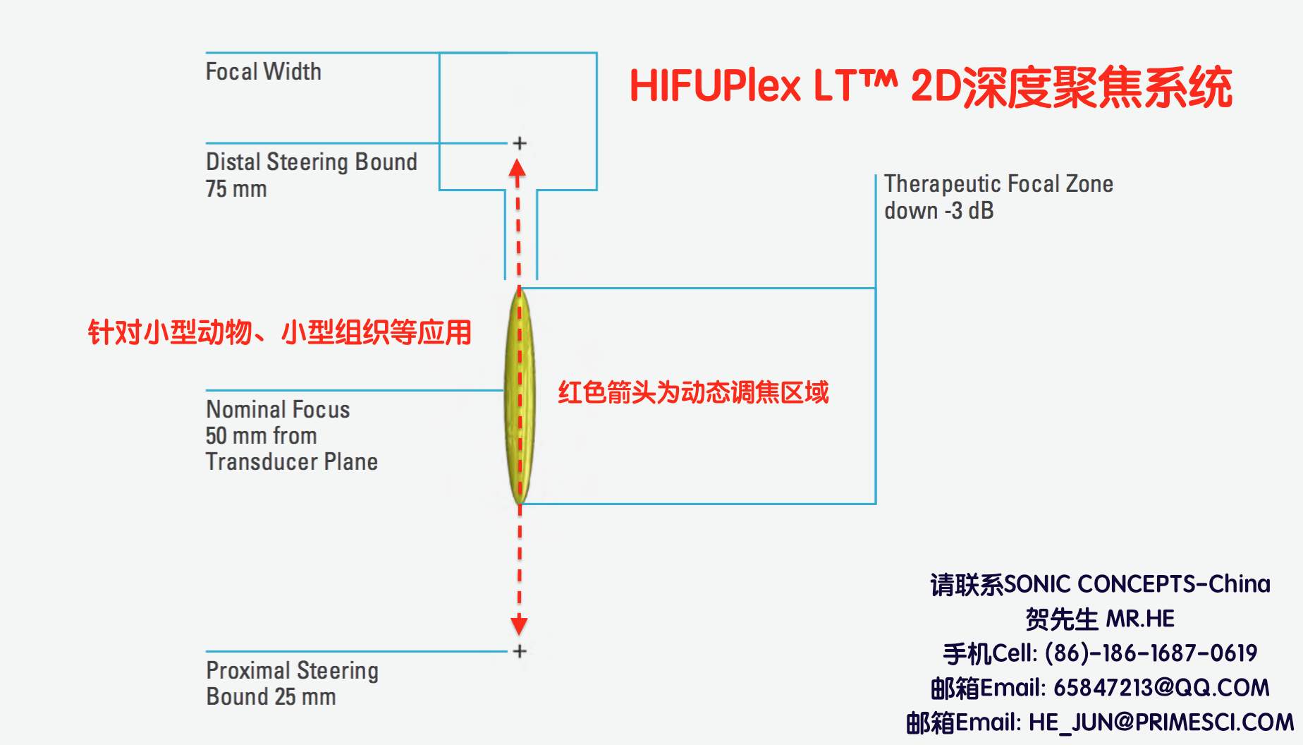 HIFUPlex LT™ 2D深度聚焦超声系统