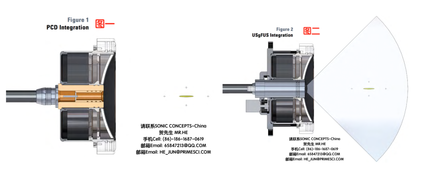 HIFUPlex LT™ 2D深度聚焦超声系统
