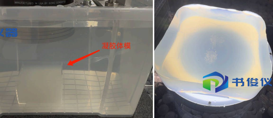 Histotripsy组织摧毁术系统方案