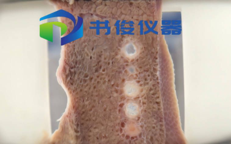 Histotripsy组织摧毁术系统方案